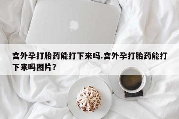 流产药怎么买要闻 第60页